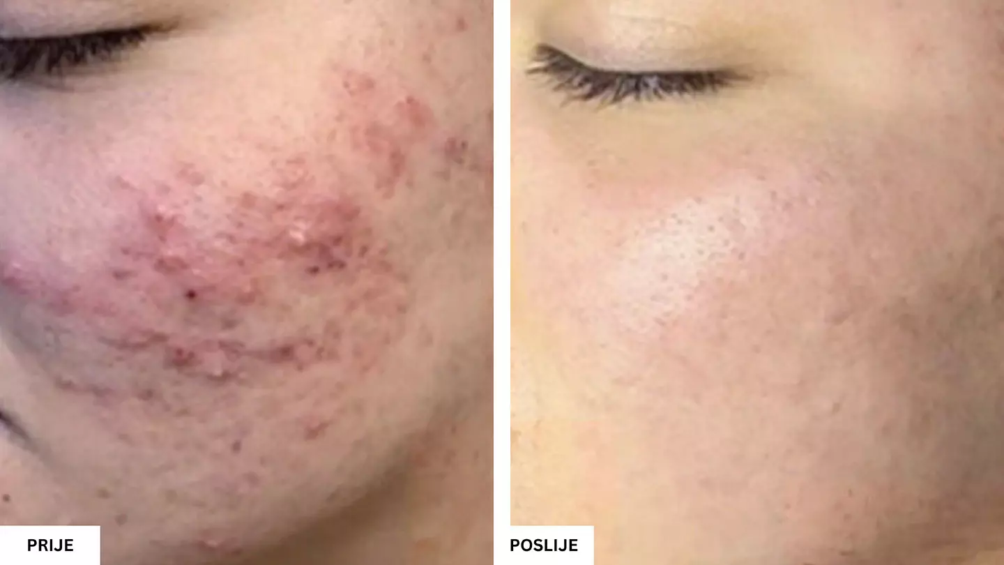 Beauty Aesthetic Centar Tuzla – Vrhunski estetski tretmani lica i tijela Beauty Aesthetic Centar Tuzla – Vrhunski estetski tretmani lica i tijela